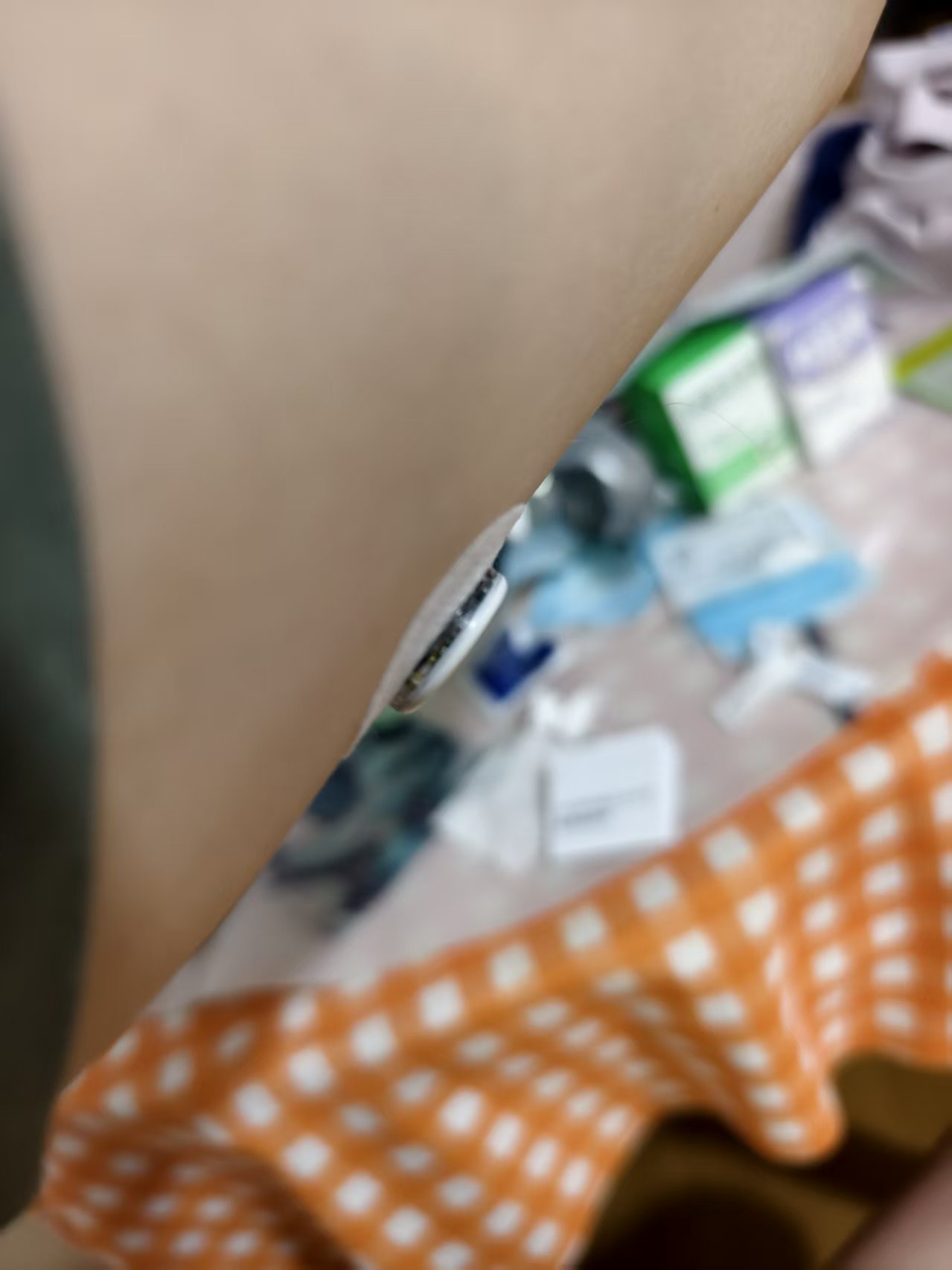 自己上的24小时血糖仪
